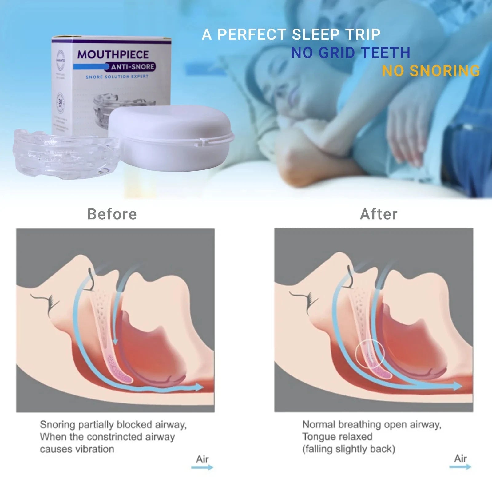 Anti-Snoring Mouth Guard Trendolya